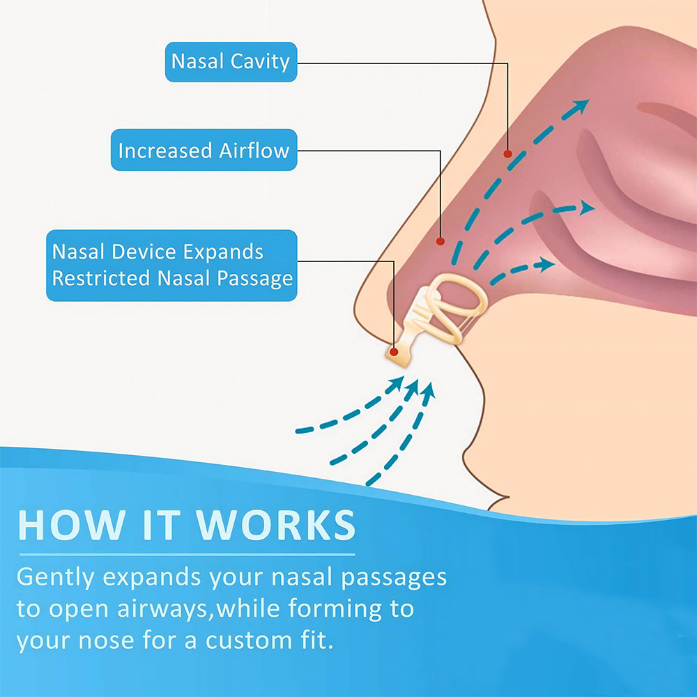 Tapón para ronquidos, dilatado - Anti Snore Contour Pillow reseña y precio